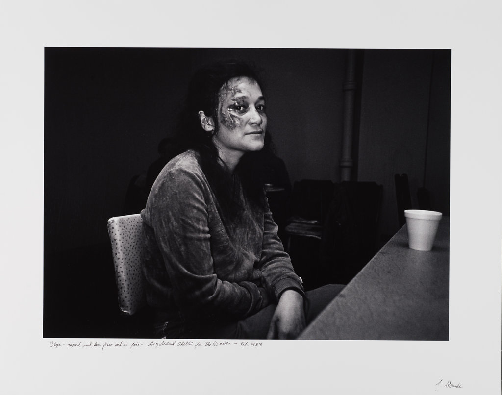 Olga, raped and set on fire, Long Island Shelter, Boston, 1983